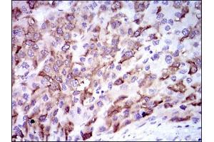 Immunohistochemistry (IHC) image for anti-Cytochrome P450, Family 3, Subfamily A, Polypeptide 4 (CYP3A4) antibody (ABIN969512)