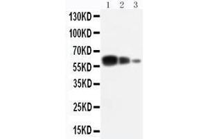 Anti-ADAM10 antibody, Western blotting Lane 1: Recombinant Human ADAM10 Protein 10ng Lane 2: Recombinant Human ADAM10 Protein 5ng Lane 3: Recombinant Human ADAM10 Protein 2. (ADAM10 antibody  (C-Term))