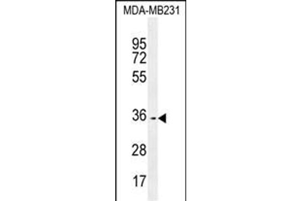 OR10Z1 antibody  (C-Term)