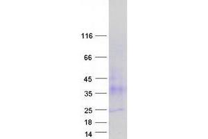 Western Blotting (WB) image for Tetraspanin 3 (TSPAN3) (Transcript Variant 3) protein (Myc-DYKDDDDK Tag) (ABIN2733439)