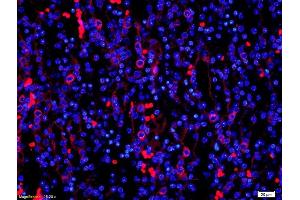 Formalin-fixed and paraffin-embedded mouse kidney labeled with Anti-PDCD4 Polyclonal Antibody, Unconjugated (ABIN731993) 1:200, overnight at 4°C, The secondary antibody was Goat Anti-Rabbit IgG, Cy3 conjugated used at 1:200 dilution for 40 minutes at 37°C. (PDCD4 antibody  (AA 1-100))