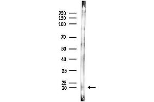 Western blot analysis of lysates from Rat brain, using NDUF Antibody at 1/1000 dilution.