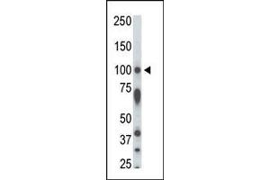 The anti-STK31 Pab is used in Western blot to detect STK31 in rat testis tissue lysate. (STK31 antibody  (N-Term))