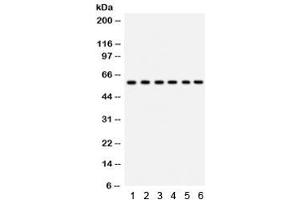 Western blot testing of 1) rat thymus, 2) rat lung, 3) HeLa, 4) 22RV1, 5) A431 and 6) mouse HEPA lysate with CYP24A1 antibody.