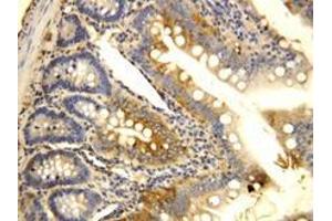 CCR6 Polyclonal Antibody (CCR6 antibody  (N-Term))