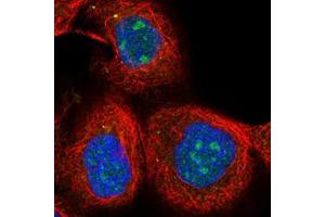 Immunofluorescent staining of human cell line A-431 with SOX7 polyclonal antibody  at 1-4 ug/mL shows positivity in nucleus, nucleoli and vesicles.
