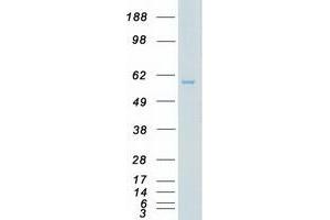 Western Blotting (WB) image for V-Akt Murine Thymoma Viral Oncogene Homolog 1 (AKT1) (Transcript Variant 3) protein (Myc-DYKDDDDK Tag) (ABIN2714511)