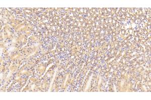 Detection of C3a in Mouse Kidney Tissue using Polyclonal Antibody to Complement Component 3a (C3a) (C3a antibody  (AA 671-748))