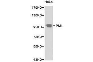 Western Blotting (WB) image for anti-Promyelocytic Leukemia (PML) antibody (ABIN1874171)