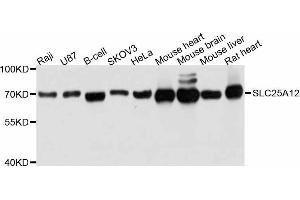 Western blot analysis of extracts of various cell lines, using SLC25A12 antibody. (SLC25A12 antibody  (AA 1-180))