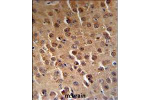 PFTK1 Antibody (N-term P82) (RB18842) IHC analysis in formalin fixed and paraffin embedded human brain tissue followed by peroxidase conjugation of the secondary antibody and DAB staining. (CDK14 antibody  (N-Term))