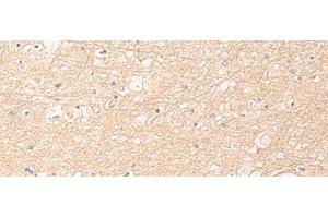 Immunohistochemistry of paraffin-embedded Human brain tissue using ELP1 Polyclonal Antibody at dilution of 1:30(x200)