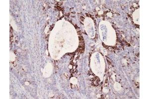 Immunohistochemistry (IHC) image for anti-Keratin 25 (KRT25) (C-Term) antibody (ABIN870621) (Keratin 25 antibody  (C-Term))