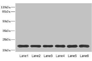Western blot All lanes: SAR1A antibody at 4. (SAR1A antibody  (AA 1-198))