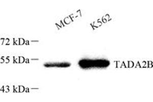 Western Blotting (WB) image for anti-Transcriptional Adaptor 2B (TADA2B) antibody (ABIN7075957)