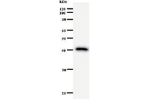 Western Blotting (WB) image for anti-Nuclear Receptor Interacting Protein 1 (NRIP1) antibody (ABIN931071)
