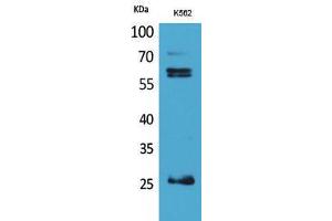 Western Blotting (WB) image for anti-Protein C Receptor, Endothelial (PROCR) (Internal Region) antibody (ABIN3178317) (PROCR antibody  (Internal Region))