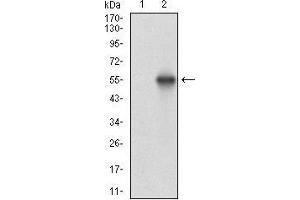 Western blot analysis using CSNK2B mAb against HEK293 (1) and CSNK2B (AA: FULL(1-215))-hIgGFc transfected HEK293 (2) cell lysate. (CSNK2B antibody  (AA 1-215))