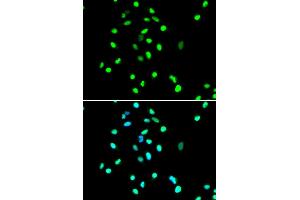 Immunofluorescence analysis of A549 cell using Jun antibody. (C-JUN antibody)