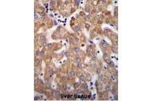 ANKRD58 Antibody (C-term) immunohistochemistry analysis in formalin fixed and paraffin embedded human liver tissue followed by peroxidase conjugation of the secondary antibody and DAB staining. (ANKRD58 antibody  (C-Term))