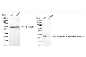 Western blotting analysis using Synaptosome associated protein 25 antibody (ABIN7800487).
