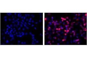 LEFT: untransfected control, RIGHT: anti-His (in red) on His-tagged fusion proteins in HEK293 cells. (His Tag antibody)