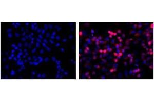 LEFT: untransfected control, RIGHT: anti-His (in red) on His-tagged fusion proteins in HEK293 cells. (His Tag antibody)