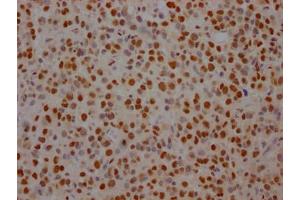 Immunohistochemistry (IHC) image for anti-Splicing Factor 3b, Subunit 1, 155kDa (SF3B1) antibody (ABIN7127805)