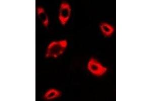 Immunofluorescent analysis of DPP8 staining in A549 cells. (DPP8 antibody)
