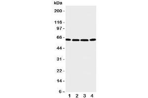 Western blot testing of P2X6 antibody and Lane 1:  U87;  2: 22RV1;  3: Jurkat;  4: HT1080 cell lysate. (P2RX6 antibody  (C-Term))
