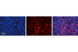 Rabbit Anti-CDK5R1 Antibody Catalog Number: ARP30200_P050 Formalin Fixed Paraffin Embedded Tissue: Human Lymph Node Tissue Observed Staining: Cytoplasm Primary Antibody Concentration: 1:600 Other Working Concentrations: N/A Secondary Antibody: Donkey anti-Rabbit-Cy3 Secondary Antibody Concentration: 1:200 Magnification: 20X Exposure Time: 0. (CDK5R1 antibody  (C-Term))