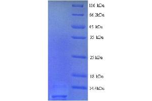 SDS-PAGE (SDS) image for Angiotensin II Receptor, Type 2 (AGTR2) (AA 1-45), (Extracellular) protein (His tag) (ABIN5713204) (Angiotensin II Type 2 Receptor Protein (AA 1-45, Extracellular) (His tag))