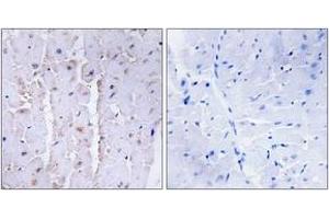 Immunohistochemistry analysis of paraffin-embedded human heart tissue, using AKAP13 Antibody. (AKAP13 antibody  (AA 721-770))