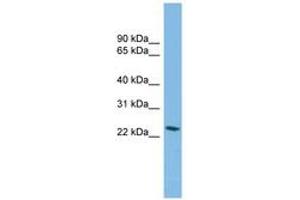 Image no. 1 for anti-Synovial Sarcoma, X Breakpoint 4 (SSX4) (AA 71-120) antibody (ABIN6744882) (SSX4 antibody  (AA 71-120))