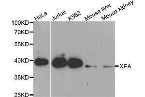 Western blot analysis of extracts of various cell lines, using XPA antibody. (XPA antibody)