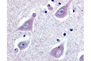 Anti-GPR30 antibody IHC of human brain, hippocampus. (GPER antibody  (Extracellular Domain))