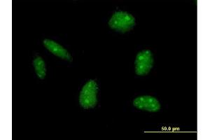 Immunofluorescence of purified MaxPab antibody to EXO1 on HeLa cell. (Exonuclease 1 antibody  (AA 1-846))