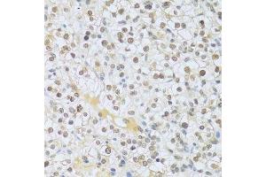 Immunohistochemistry (Paraffin-embedded Sections) (IHC (p)) image for anti-Mitogen-Activated Protein Kinase 3 (MAPK3) (AA 1-100) antibody (ABIN3020725)