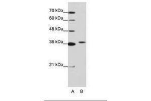 Image no. 1 for anti-Exosome Component 7 (EXOSC7) (AA 71-120) antibody (ABIN202173)