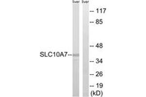 Western blot analysis of extracts from mouse liver cells, using SLC10A7 Antibody. (SLC10A7 antibody  (AA 168-217))