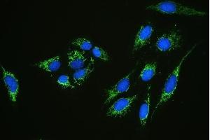 IF analysis of C1QBP using anti-C1QBP antibody (ABIN4886491).
