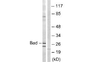 Immunohistochemistry analysis of paraffin-embedded human brain tissue using BAD (Ab-134) antibody. (BAD antibody)