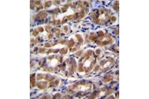 Formalin fixed and paraffin embedded human stomach tissue reacted with FABP2 Antibody (N-term) followed by peroxidase conjugation of the secondary antibody and DAB staining. (FABP2 antibody  (N-Term))