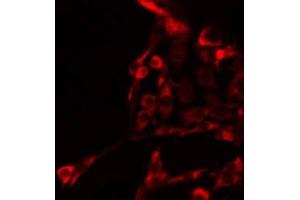 ABIN6278063 staining HepG2 by IF/ICC. (GRIA4 antibody)