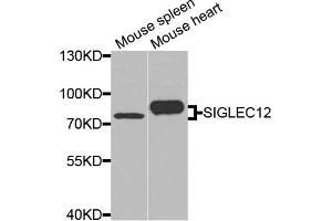 Western blot analysis of extracts of mouse spleen and mouse heart cells, using SIGLEC12 antibody. (SIGLEC12 antibody)
