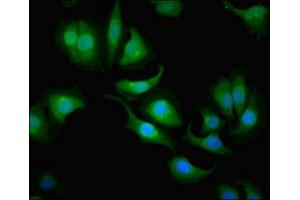 Immunofluorescent analysis of A549 cells using ABIN7146698 at dilution of 1:100 and Alexa Fluor 488-congugated AffiniPure Goat Anti-Rabbit IgG(H+L) (CA1 antibody  (AA 2-261))