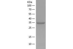 Western Blotting (WB) image for E74-Like Factor 1 (Ets Domain Transcription Factor) (ELF1) (AA 366-412) protein (His tag) (ABIN7122730) (ELF1 Protein (AA 366-412) (His tag))