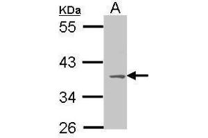 WB Image Sample (30 ug of whole cell lysate) A: Molt-4 , 10% SDS PAGE antibody diluted at 1:1000 (MC1 Receptor antibody  (C-Term))