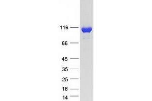 Validation with Western Blot (MVP Protein (Transcript Variant 2) (Myc-DYKDDDDK Tag))