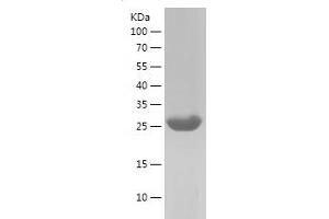 Western Blotting (WB) image for PTK2 Protein tyrosine Kinase 2 (PTK2) (AA 845-1052) protein (His tag) (ABIN7124708) (FAK Protein (AA 845-1052) (His tag))